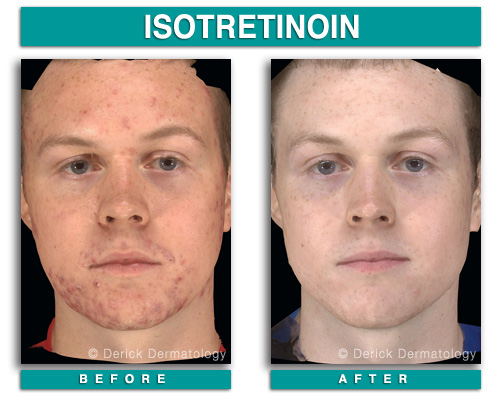 Dermatology Before and After | Botox, Latisse, CoolSculpting