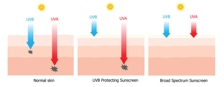 Ultraviolet Rays and Sunscreens - Derick Dermatology