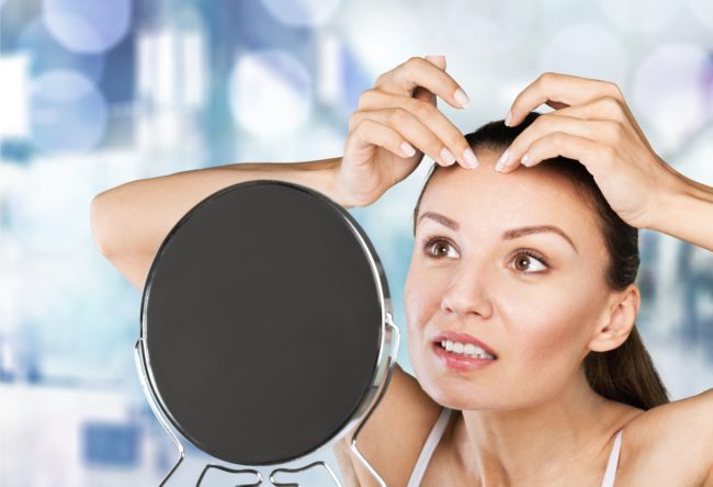Acne Scars woman looking at a pimple on her forehead in mirror