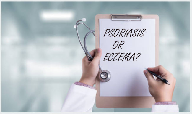 Psoriasis vs Eczema doctor holding a clip board with paper that says "psoriasis or eczema?"