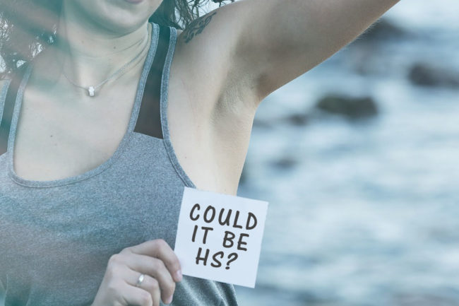 Hidradenitis Suppurativa