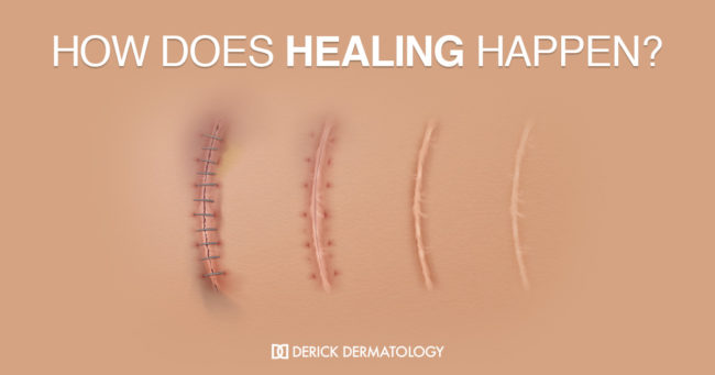 How does healing happen? How does healing happen?