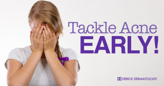 Tackle Acne Early Tackle Acne Early