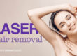 Laser Hair Removal Treatments