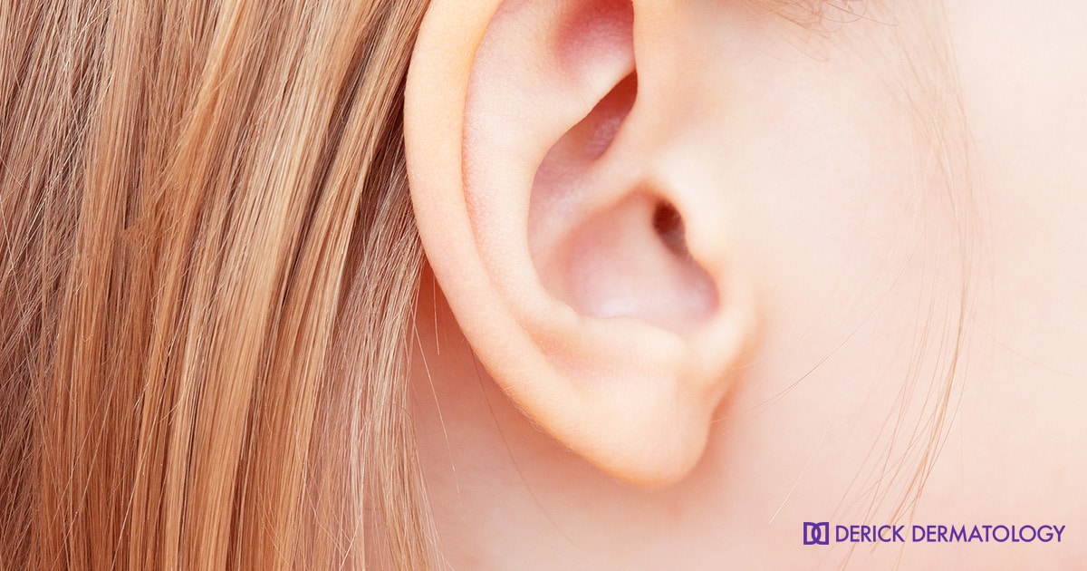 The Right Approach to Split Ear Lobe Repair