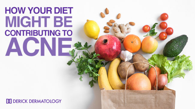 Acne Diet