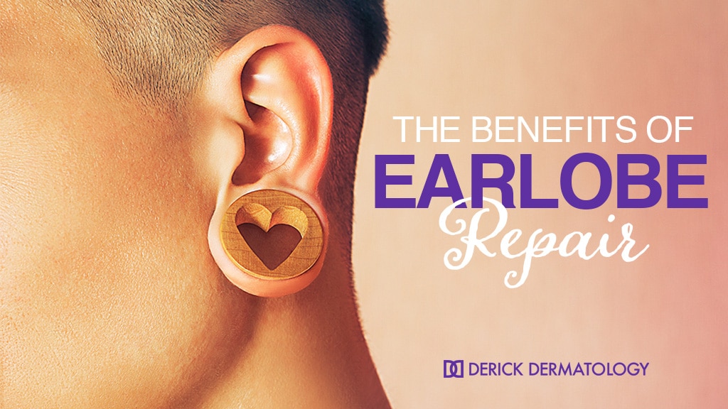 Skin and You » Ear Lobe Repair