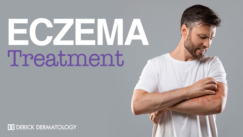 Eczema Treatment Chicago Dermatology