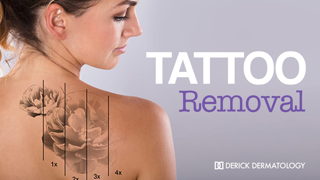 What You Need to Know About Tattoo Removal Aftercare? - Estetiq  International