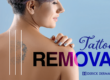 Learn About Tattoo Removal