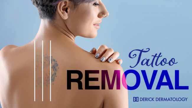 Learn About Tattoo Removal