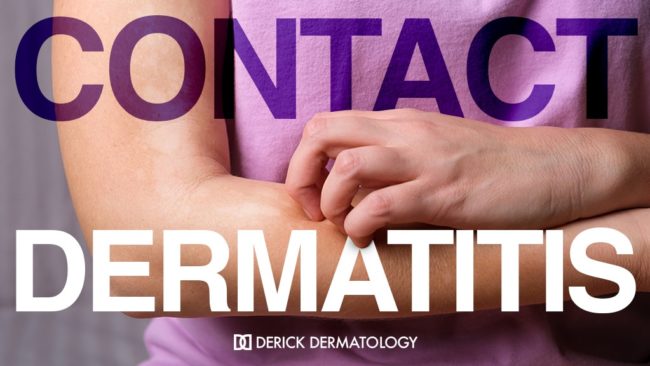 About Contact Dermatitis