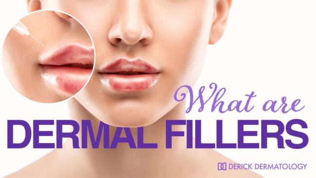 What are Dermal Fillers?