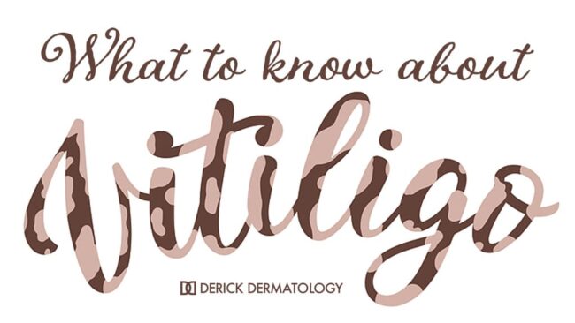 Dermatology Near Me What to Know About Vitiligo
