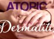 Atopic, Dermatitis, Dermatology, Dermatologist